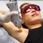 Lunettes_Versailles_YAG_FEMME