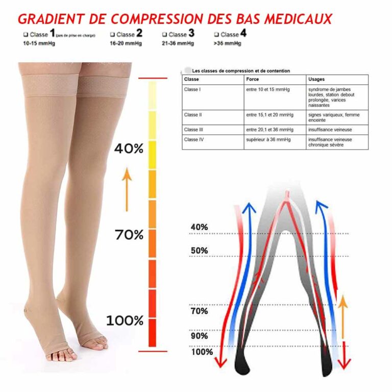 Contention Laser Versailles